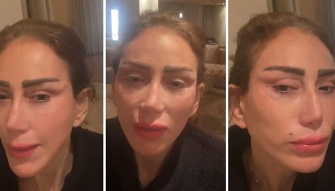 عملية تجميل تشوّه الإعلامية المصرية ريهام سعيد